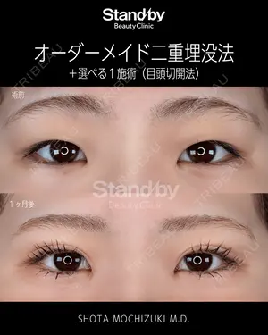 30 days after image