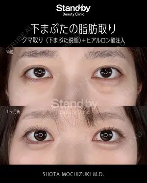 30 days after image