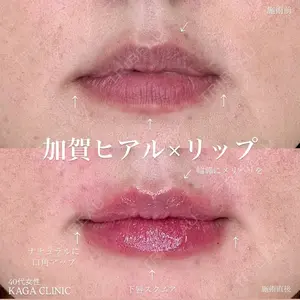 0 days after image