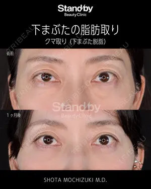before image