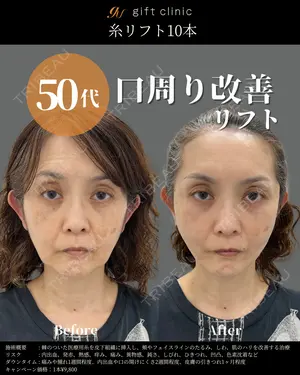 0 days after image