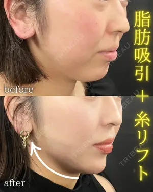 7 days after image