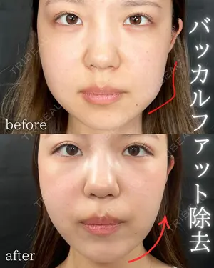 30 days after image