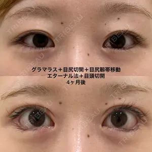 before image