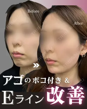 0 days after image