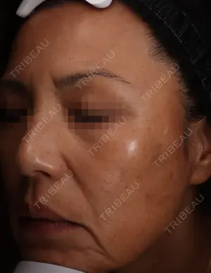 30 days after image