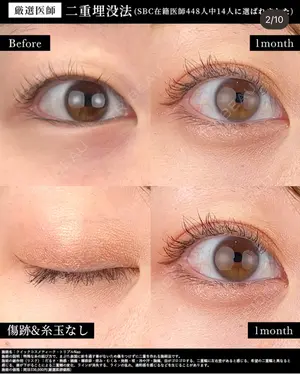 before image