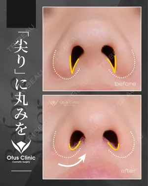 180 days after image