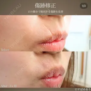 before image