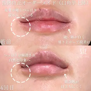 before image
