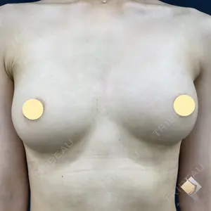 180 days after image