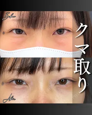 before image