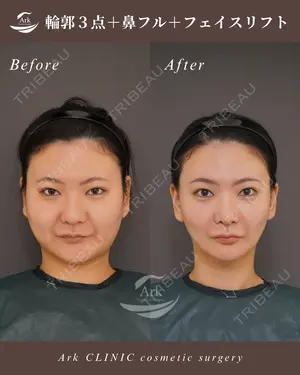 180 days after image