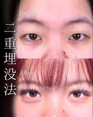before image