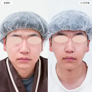 75 days after image