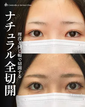 88 days after image