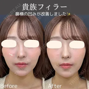 0 days after image