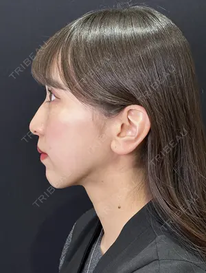 1 days after image
