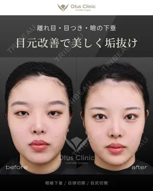 180 days after image