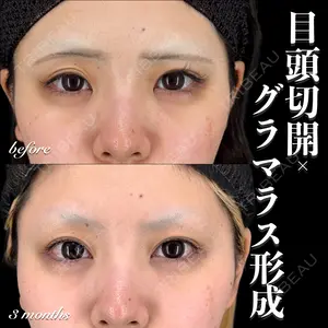 90 days after image