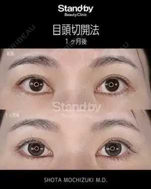 30 days after image
