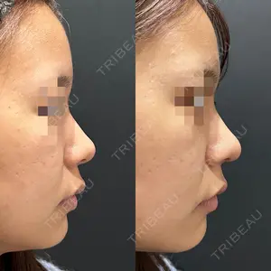 30 days after image