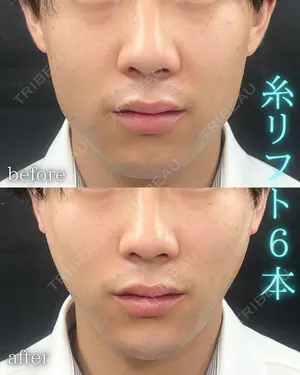 0 days after image