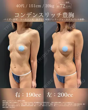 90 days after image
