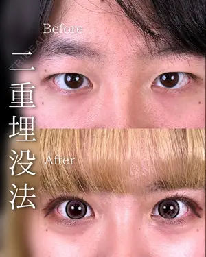 before image