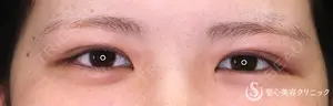 30 days after image