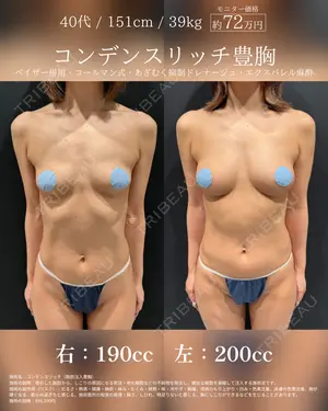 90 days after image