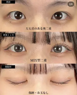before image