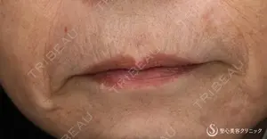 30 days after image