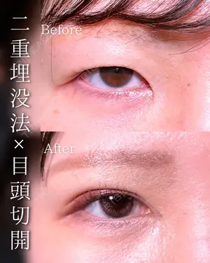 before image