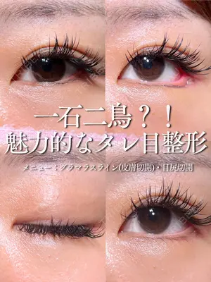 30 days after image