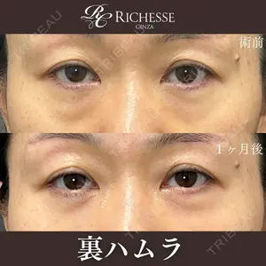 30 days after image