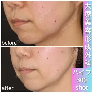 before image