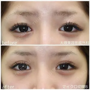 before image