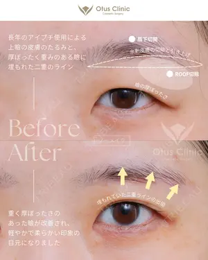 before image