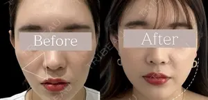 0 days after image