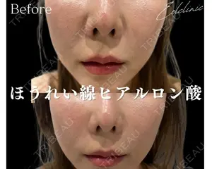 0 days after image