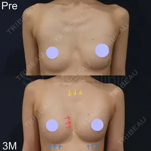 180 days after image