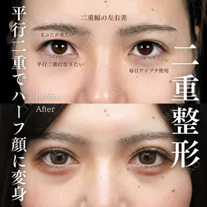 90 days after image