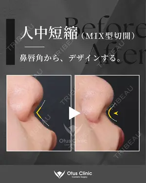 90 days after image