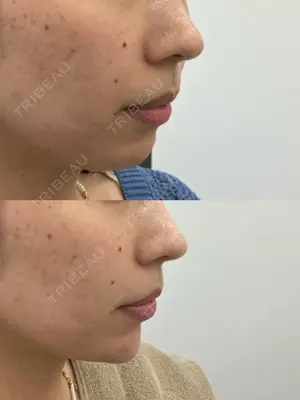 before image