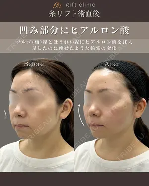 before image