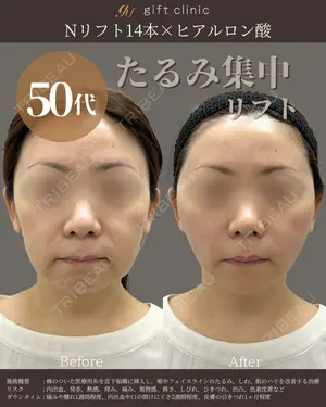 0 days after image