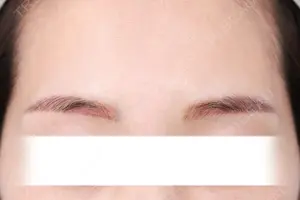 before image