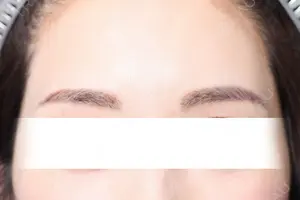14 days after image