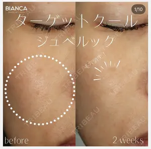 before image